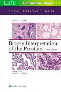 Biopsy interpretation of the prostate